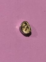 tooth in cap.JPG